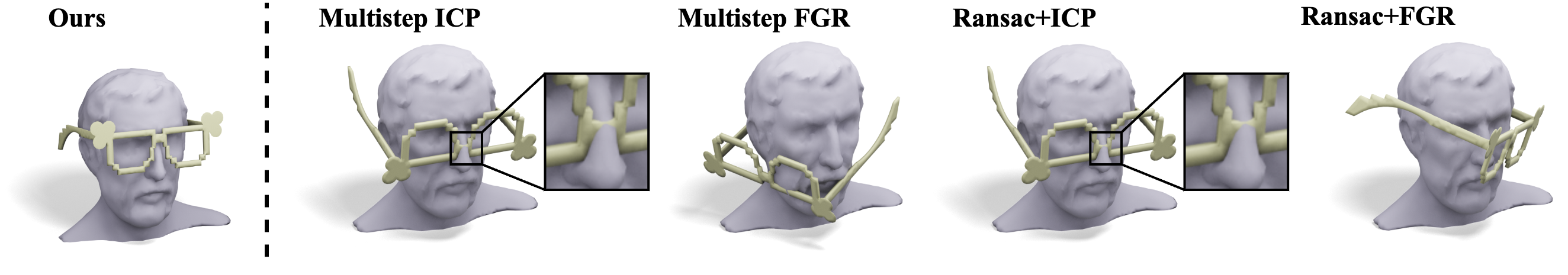 Comparison of MeshOn against classical registration baselines with blowup insets